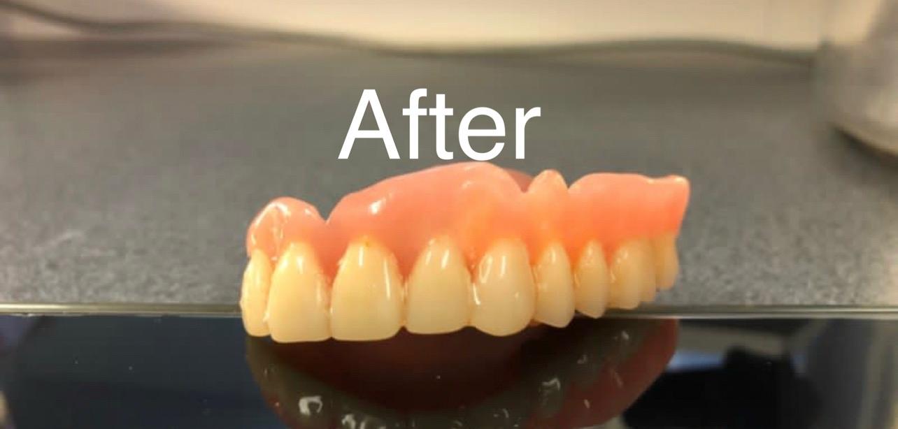 After repair