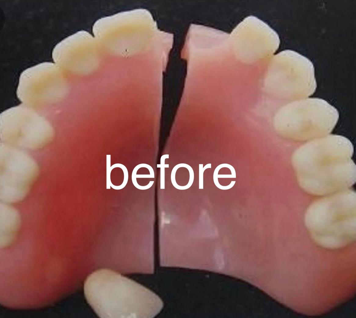 Before repair